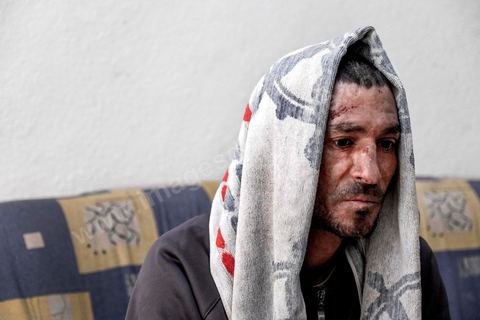 25 février 2016 : Baligh Aloui, 33 ans, s'est immolé le jeudi 21 janvier devant sa maison familiale où il vit avec ses parents, frères et soeur. C'est son frère, Abdelsattar, qui l'a sauvé en se jetant sur lui. Il est brulé au visage et mains au second degrès. Il s'est immolé ce jeudi 21 janvier, au lendemain de l'annonce de la création de 5000 emplois à Kasserine par le gouvernement. Ce jour là, les chômeurs se sont précipités au gouvernorat, aux délégations et aux municipalités pour s'inscrire dans un nouvel espoir d'avoir enfin un travail, une activité stable, un revenu digne, ... cet afflux a créé un désordre, un débordement, des tensions, ... ce jeune se voyant une nouvelle fois rejeté par l'administration, par l'état, est rentré chez lui avec une bouteille d'essence et s'est immolé dans la rue devant sa maison, devant sa mère, ses frères et soeurs. C'est à son frère qu'il doit sa survie, il a pu très vite l'éteindre, mais ce jeune est marqué à vie, brulé au second degrés sur l'ensemble du visage dans l'indifférence totale de la société et du gouvernement, en 2015 113 personnes se sont immolés en Tunisie.