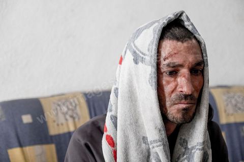 25 février 2016 : Baligh Aloui, 33 ans, s'est immolé le jeudi 21 janvier devant sa maison familiale où il vit avec ses parents, frères et soeur. C'est son frère, Abdelsattar, qui l'a sauvé en se jetant sur lui. Il est brulé au visage et mains au second degrès. Il s'est immolé ce jeudi 21 janvier, au lendemain de l'annonce de la création de 5000 emplois à Kasserine par le gouvernement. Ce jour là, les chômeurs se sont précipités au gouvernorat, aux délégations et aux municipalités pour s'inscrire dans un nouvel espoir d'avoir enfin un travail, une activité stable, un revenu digne, ... cet afflux a créé un désordre, un débordement, des tensions, ... ce jeune se voyant une nouvelle fois rejeté par l'administration, par l'état, est rentré chez lui avec une bouteille d'essence et s'est immolé dans la rue devant sa maison, devant sa mère, ses frères et soeurs. C'est à son frère qu'il doit sa survie, il a pu très vite l'éteindre, mais ce jeune est marqué à vie, brulé au second degrés sur l'ensemble du visage dans l'indifférence totale de la société et du gouvernement, en 2015 113 personnes se sont immolés en Tunisie.