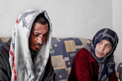 25 février 2016 : Baligh Aloui, 33 ans, s'est immolé le jeudi 21 janvier devant sa maison familiale où il vit avec ses parents, frères et soeur. C'est son frère, Abdelsattar, qui l'a sauvé en se jetant sur lui. Il est brulé au visage et mains au second degrès. Il s'est immolé ce jeudi 21 janvier, au lendemain de l'annonce de la création de 5000 emplois à Kasserine par le gouvernement. Ce jour là, les chômeurs se sont précipités au gouvernorat, aux délégations et aux municipalités pour s'inscrire dans un nouvel espoir d'avoir enfin un travail, une activité stable, un revenu digne, ... cet afflux a créé un désordre, un débordement, des tensions, ... ce jeune se voyant une nouvelle fois rejeté par l'administration, par l'état, est rentré chez lui avec une bouteille d'essence et s'est immolé dans la rue devant sa maison, devant sa mère, ses frères et soeurs. C'est à son frère qu'il doit sa survie, il a pu très vite l'éteindre, mais ce jeune est marqué à vie, brulé au second degrés sur l'ensemble du visage dans l'indifférence totale de la société et du gouvernement, en 2015 113 personnes se sont immolés en Tunisie.