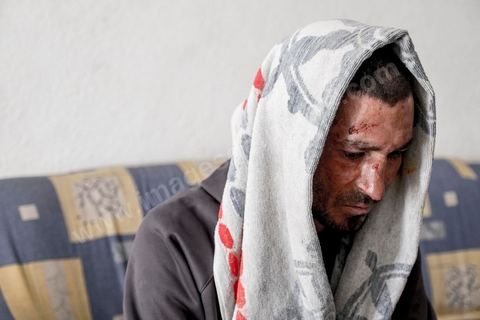 25 février 2016 : Baligh Aloui, 33 ans, s'est immolé le jeudi 21 janvier devant sa maison familiale où il vit avec ses parents, frères et soeur. C'est son frère, Abdelsattar, qui l'a sauvé en se jetant sur lui. Il est brulé au visage et mains au second degrès. Il s'est immolé ce jeudi 21 janvier, au lendemain de l'annonce de la création de 5000 emplois à Kasserine par le gouvernement. Ce jour là, les chômeurs se sont précipités au gouvernorat, aux délégations et aux municipalités pour s'inscrire dans un nouvel espoir d'avoir enfin un travail, une activité stable, un revenu digne, ... cet afflux a créé un désordre, un débordement, des tensions, ... ce jeune se voyant une nouvelle fois rejeté par l'administration, par l'état, est rentré chez lui avec une bouteille d'essence et s'est immolé dans la rue devant sa maison, devant sa mère, ses frères et soeurs. C'est à son frère qu'il doit sa survie, il a pu très vite l'éteindre, mais ce jeune est marqué à vie, brulé au second degrés sur l'ensemble du visage dans l'indifférence totale de la société et du gouvernement, en 2015 113 personnes se sont immolés en Tunisie.