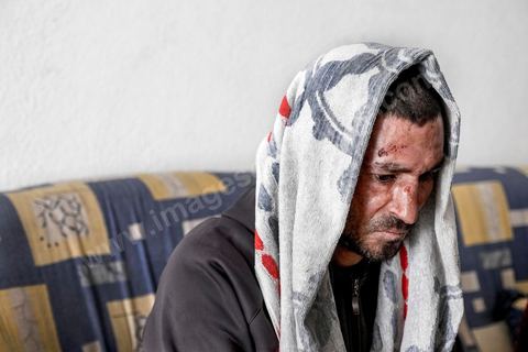 25 février 2016 : Baligh Aloui, 33 ans, s'est immolé le jeudi 21 janvier devant sa maison familiale où il vit avec ses parents, frères et soeur. C'est son frère, Abdelsattar, qui l'a sauvé en se jetant sur lui. Il est brulé au visage et mains au second degrès. Il s'est immolé ce jeudi 21 janvier, au lendemain de l'annonce de la création de 5000 emplois à Kasserine par le gouvernement. Ce jour là, les chômeurs se sont précipités au gouvernorat, aux délégations et aux municipalités pour s'inscrire dans un nouvel espoir d'avoir enfin un travail, une activité stable, un revenu digne, ... cet afflux a créé un désordre, un débordement, des tensions, ... ce jeune se voyant une nouvelle fois rejeté par l'administration, par l'état, est rentré chez lui avec une bouteille d'essence et s'est immolé dans la rue devant sa maison, devant sa mère, ses frères et soeurs. C'est à son frère qu'il doit sa survie, il a pu très vite l'éteindre, mais ce jeune est marqué à vie, brulé au second degrés sur l'ensemble du visage dans l'indifférence totale de la société et du gouvernement, en 2015 113 personnes se sont immolés en Tunisie.