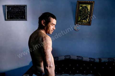 January 19, 2018: In the El Borj neighborhood of Mdhilla, MOHAMED TLIJANI, 45 years old, father of four children, the youngest of whom is 8 months old. The maintenance technician suffered third-degree burns during a sulfuric acid leak at the Mdhilla chemical plant on May 18, 2016. Sixteen people were seriously injured in the accident, one of whom died. 