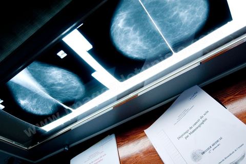 Service gratuit de mamographie au Centre de Recherche en Santé de la Repproduction de l'Ariana à Tunis - Office national de la Famille et de la Population - Ministère de la Santé Publique